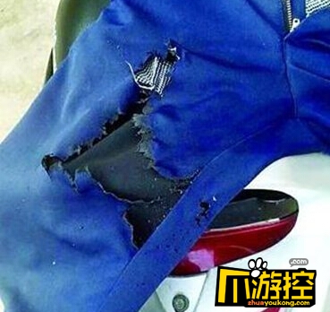 小伙小米手机裤兜爆炸 目前小米公司正对手机